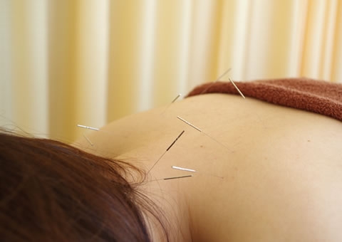 自宅に伺っての治療